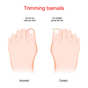 toenails toenails