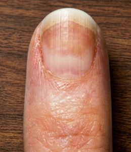 Lindsay nail Lindsay nail