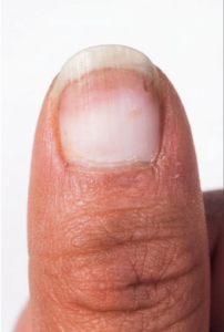 Terry nail Terry nail