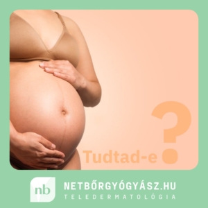 NetBőrgyógyász.hu | Linea nigra