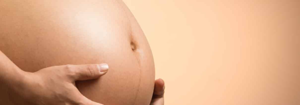 NetBőrgyógyász.hu | A “terhesség védjegye” vagyis a linea nigra
