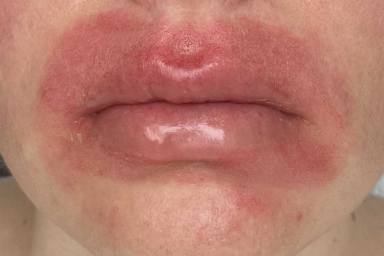lip licker lip licker